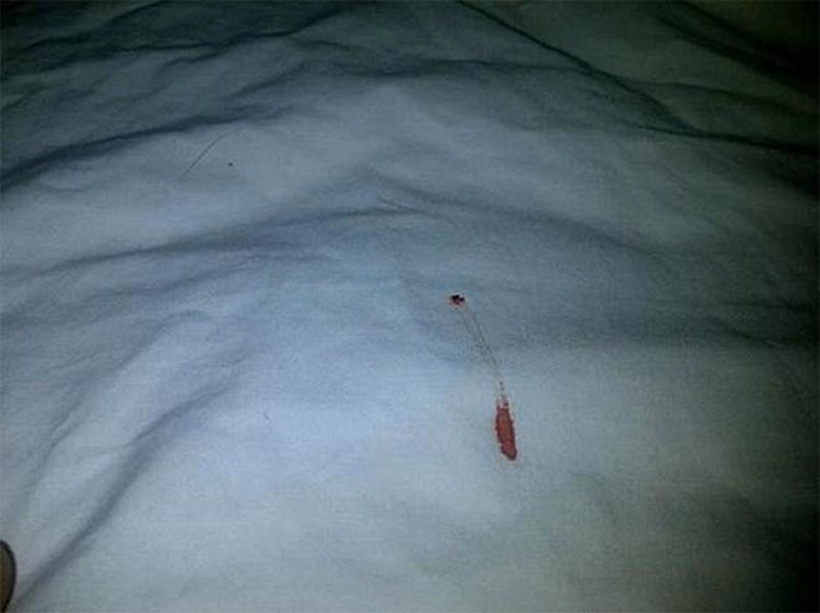 operatie-restabilire-virginitate-china